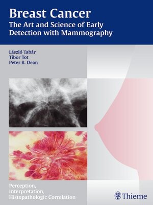 cover image of Breast Cancer--The Art and Science of Early Detection with Mammography